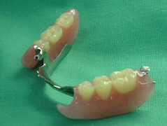 札幌南区近郊にも歯医者さんは多くありますが、専門性の高い義歯入れ歯治療の歯科クリニックは少ないかと思われます。当院の痛くなく良く噛める入れ歯のページです。下顎の遊離端欠損の場合の入れ歯製作例。
