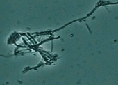 札幌南区北の沢夜間歯科・矯正歯科。歯周病レーザー治療。位相差顕微鏡で見た細菌の写真。