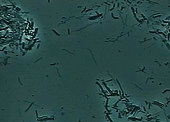 札幌南区北の沢夜間歯科・矯正歯科。歯周病レーザー治療。位相差顕微鏡で見た細菌の写真。