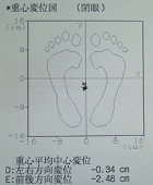 矯正機器3。グラビコーダーの分析結果の例。