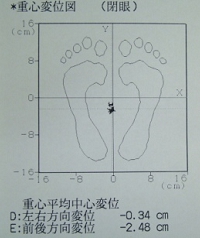 噛みあわせ矯正機器データ
