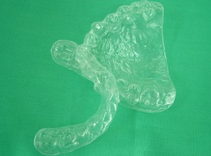 噛みあわせ矯正症例2。アライナーのサンプル。